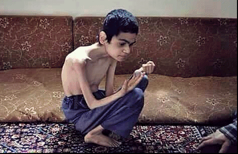 সিরিয়াতে অপুষ্টি-অনাহারে দিন কাটাচ্ছে ৪ লাখ মানুষ - image